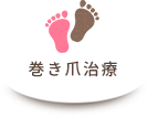 巻き爪治療